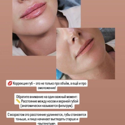 미래를 위해 자신의 전문성을 지속적으로 향상시키는 진정한 전문가 율리아, @NEO_GEO_Beauty