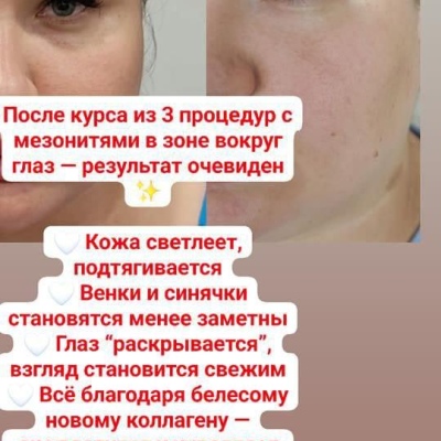 미래를 위해 자신의 전문성을 지속적으로 향상시키는 진정한 전문가 율리아, @NEO_GEO_Beauty