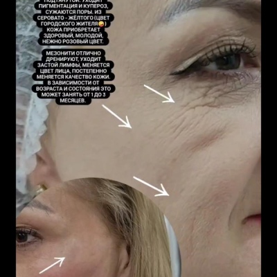 미래를 계속해서 향해가는 성실한 전문가 율리아, @NEO_GEO_Beauty